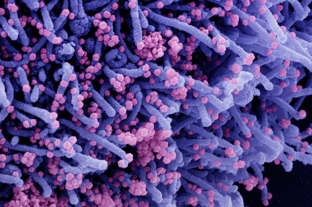 Pandemia: Média móvel de mortes por covid-19 é a menor desde abril de 2020