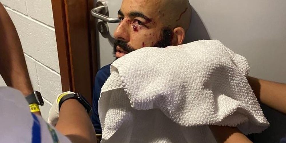 Atentado: Ônibus do Bahia é atingido por bomba a caminho da Arena Fonte Nova