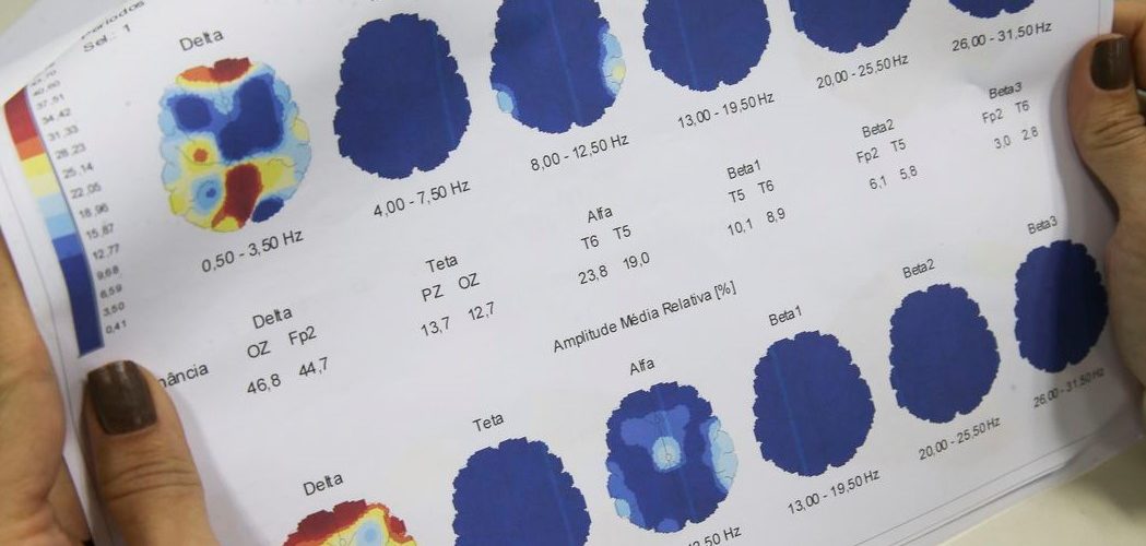 Saúde: Março Roxo quer conscientizar população sobre a epilepsia