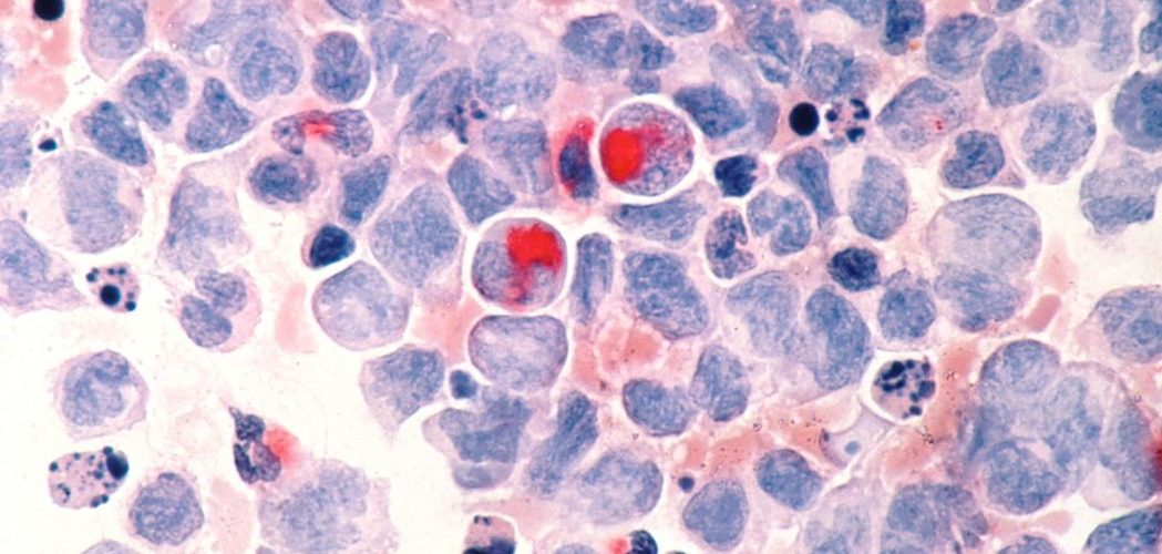 Saúde: ANS inclui opções de quimioterapia oral em seu rol de procedimentos