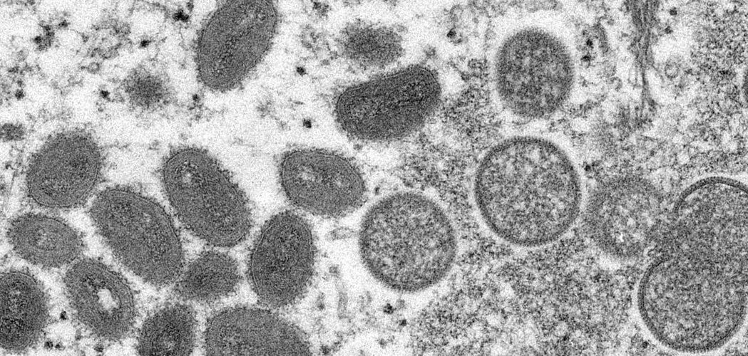 Saúde: Fiocruz conclui sequenciamento genético do vírus Monkeypox