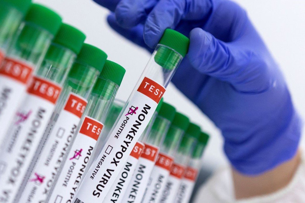 Monkeypox: Fiocruz produz insumos para diagnóstico da varíola dos macacos