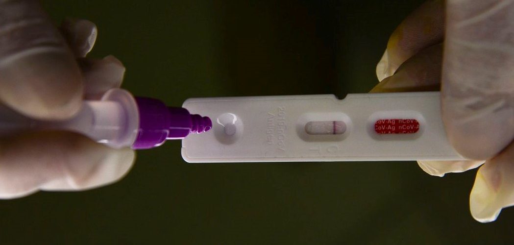 Saúde: Pesquisadores identificam método capaz de prever gravidade da covid-19