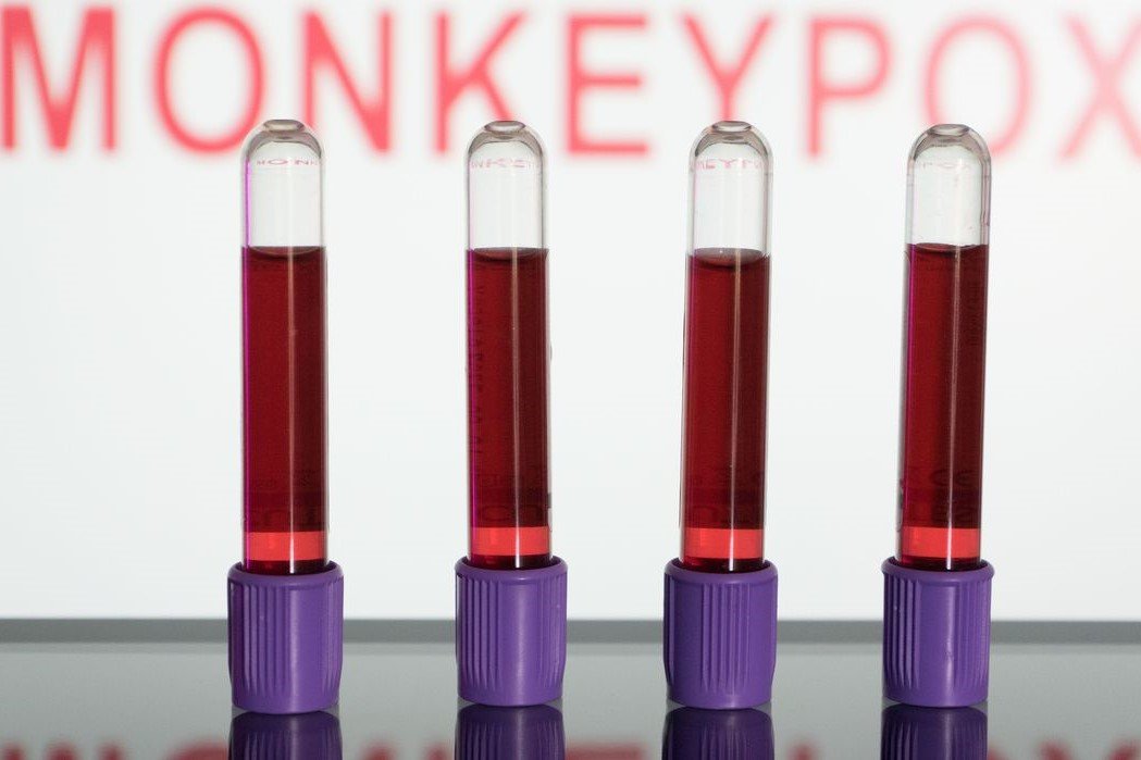 Monkeypox: Primeiras vacinas contra varíola dos macacos devem chegar em setembro