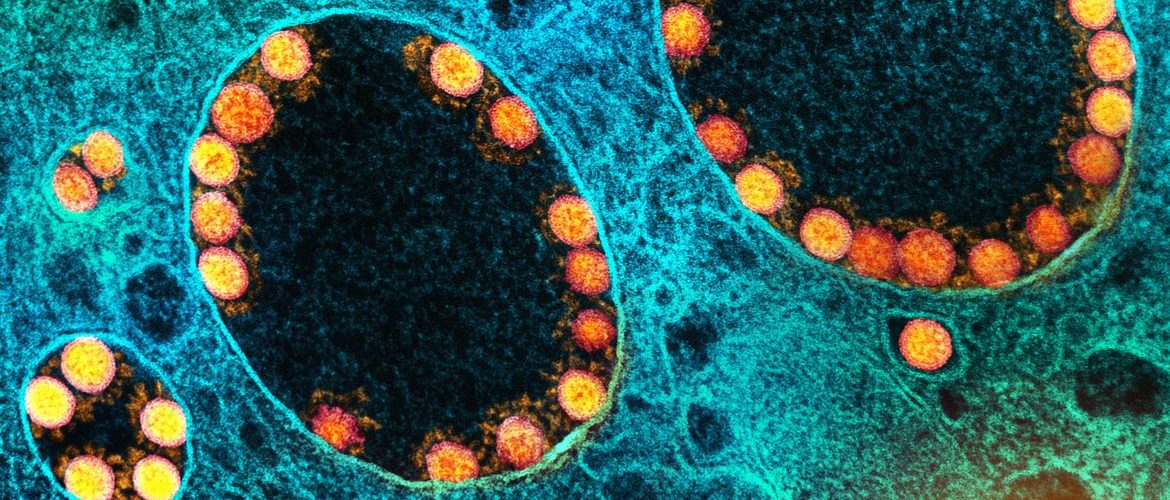 Mulher tinha 72 anos e várias comorbidades. | Foto: Reprodução