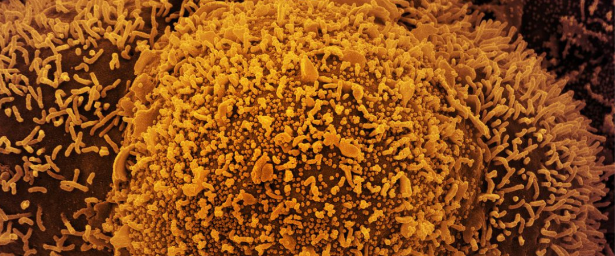 Os casos com comprovação laboratorial para o vírus Sars-CoV-2 se referem à semana epidemiológica 44, de 30 de outubro a 5 de novembro. | Foto: NAID