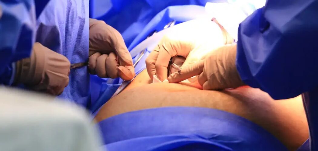 Cinco estados podem zerar fila de cirurgias no SUS