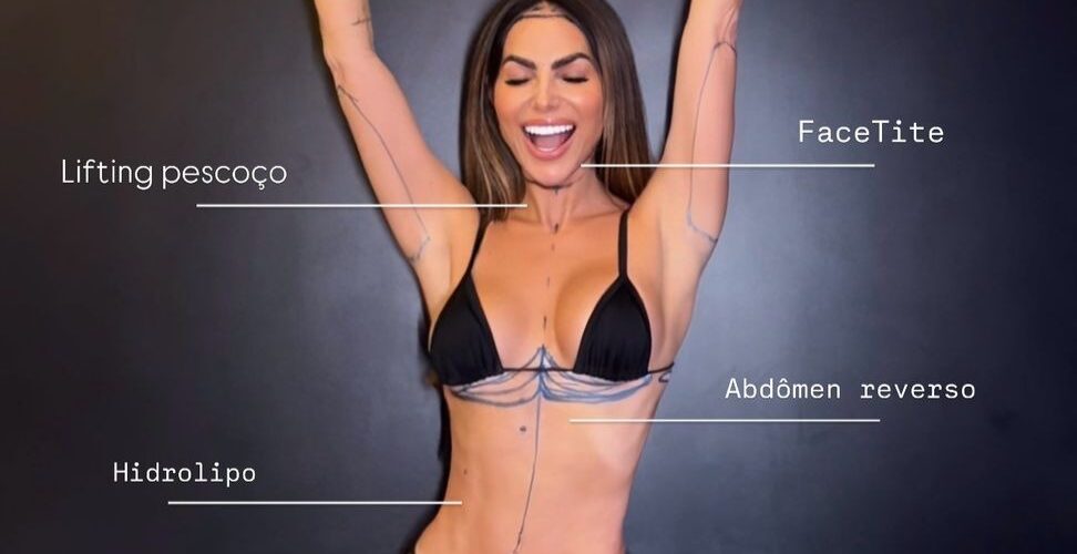 Estética: Jamile Lima exibe transformação