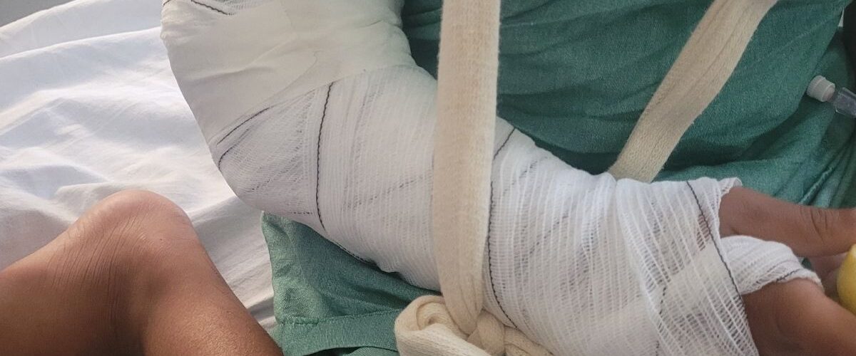 Saúde: IJF emite alerta para pais sobre aumento de acidentes com crianças nas férias escolares