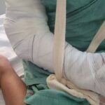 Saúde: IJF emite alerta para pais sobre aumento de acidentes com crianças nas férias escolares