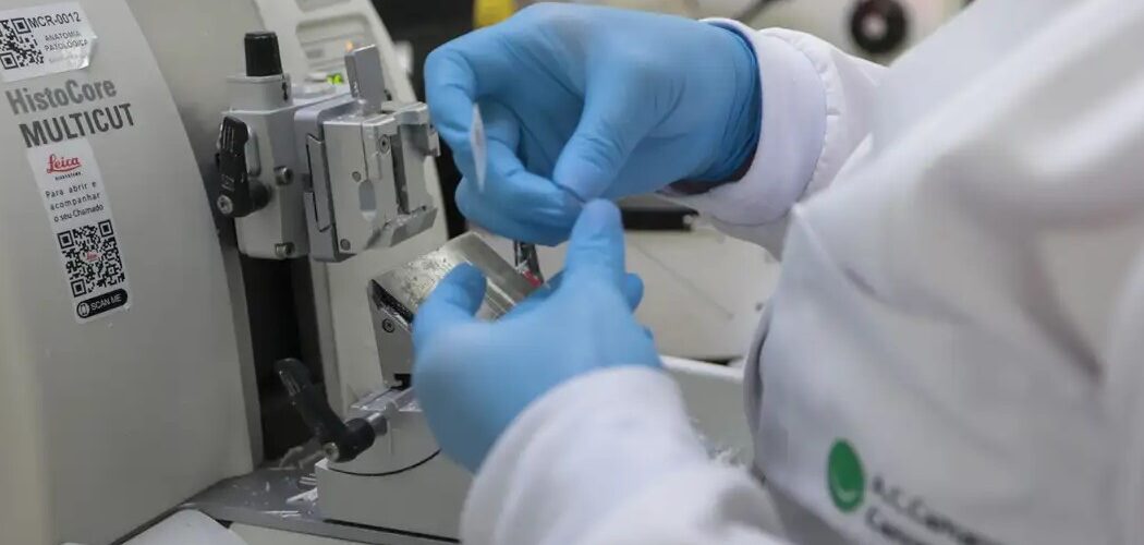 Saúde: Cura do câncer de próstata pode chegar a 98%, aponta especialista da Sociedade Brasileira de Urologia