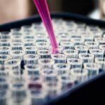 Saúde: Pesquisadores brasileiros avançam no diagnóstico precoce da doença de Alzheimer