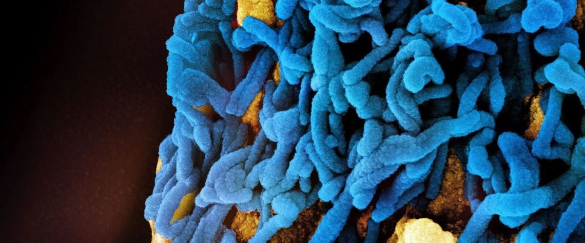 Saúde: Etiópia confirma surto do vírus Marburg, altamente letal e da mesma família do ebola