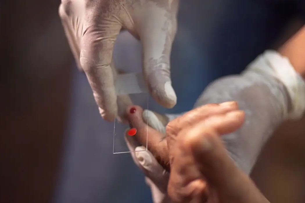 Saúde: SUS amplia tratamento contra malária infantil