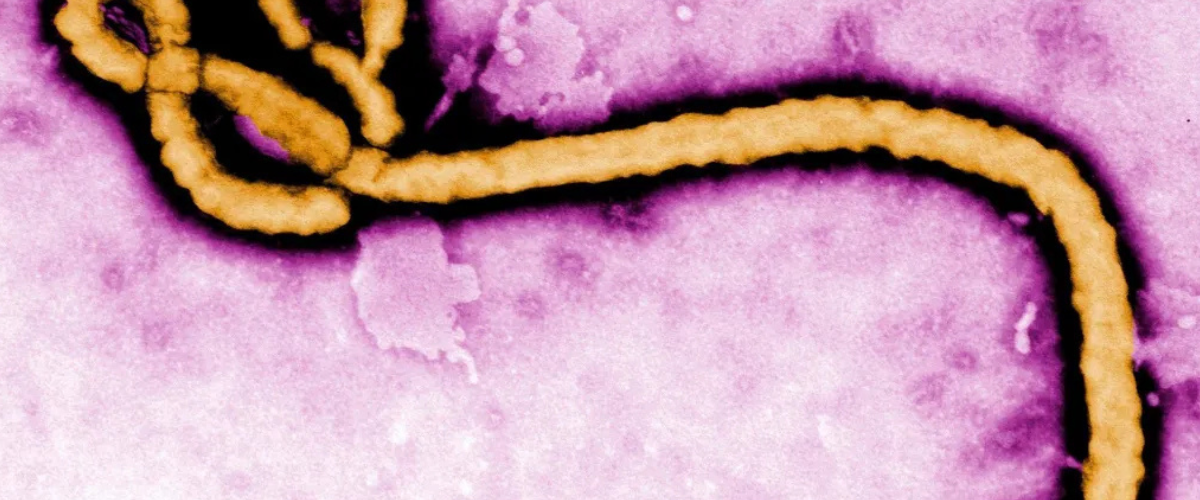 Saúde: SP investiga caso suspeito de Ebola