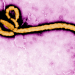 Saúde: SP investiga caso suspeito de Ebola