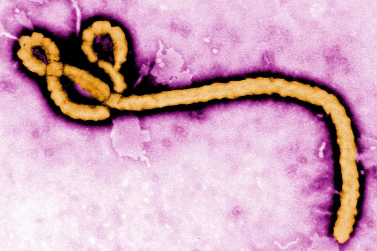 Saúde: SP investiga caso suspeito de Ebola