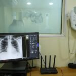 Saúde: IR ainda ignora diagnóstico de doenças raras