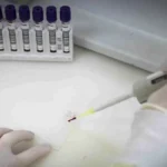 SP investiga novo caso suspeito de ebola em brasileira
