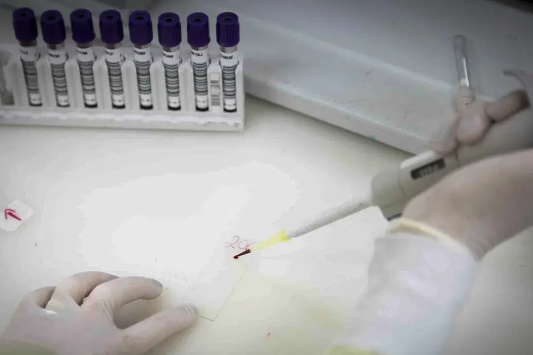SP investiga novo caso suspeito de ebola em brasileira