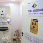 Cirurgias de mama no SUS crescem 54% em dez anos