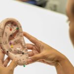 Saúde: Auriculoterapia apoia mães atípicas no Ceará