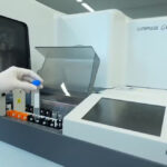 Exame de sangue para Alzheimer chega ao Brasil