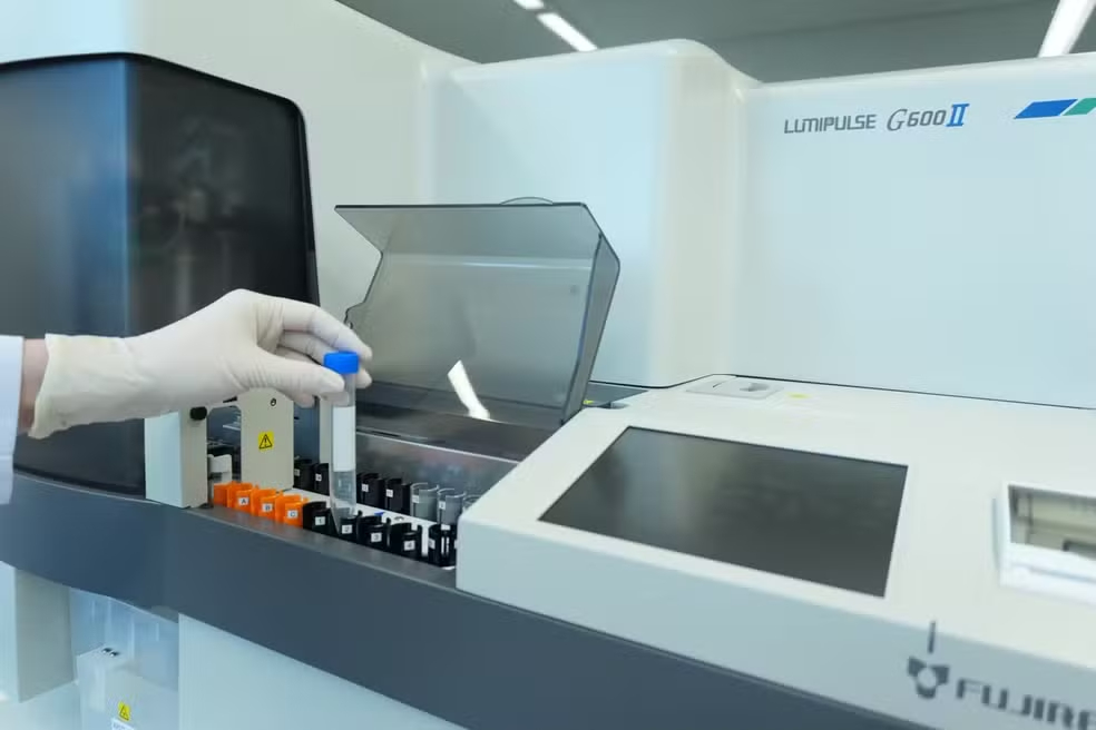 Exame de sangue para Alzheimer chega ao Brasil